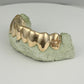Solid Gold Grillz (White, Yellow, Rose Gold Options)