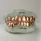 Solid Gold Grillz (White, Yellow, Rose Gold Options)